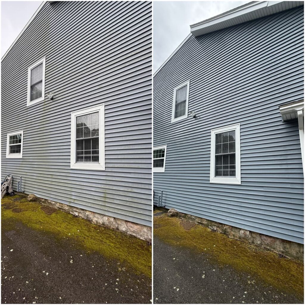 summit before and after North Attleboro MA